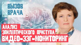 Видео-ЭЭГ-мониторинг нужно срочно делать, если подозреваете эпилепсию – ВВ#7 - Лариса Глухова