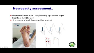 EVALUATION OF DIABETIC FOOT