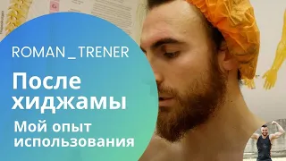 После хиджамы [Мой опыт использования]