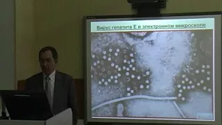 Лекция 14 «Семейство Калицивирусов  Вирус гепатита Е  Астровирусы »