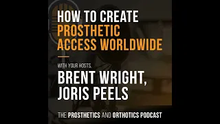 Creating Global Access to Prostheses: Joris and Brent Talk About Challenges and Solutions