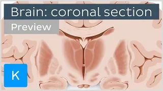 Coronal section of the brain at the level of the thalamus (preview) - Human Anatomy | Kenhub