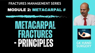 Finger Metacarpal fractures: Basic principles of management