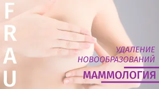 С.М.Портной Удаление новообразований