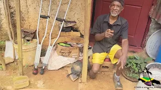 Meet Farmer whose leg was amputated shares his story!