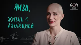 Лиза. Жизнь с алопецией. Интервью для вМесте