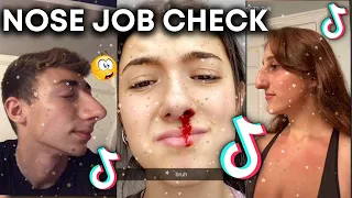 Nose Job Check #1 👃🏼 ~ TikTok Compilation 😘