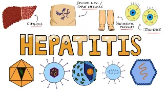 Viral Hepatitis - How Does Hepatitis Affect The Liver?  Acute vs Chronic Hepatitis