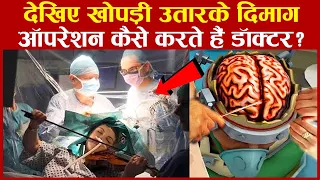 देखिए खोपड़ी खोल कर दिमाग का ऑपरेशन कैसे होता है ? | Human Brain Surgery