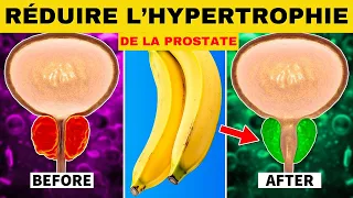 Top 6 des fruits pour réduire une hypertrophie de la prostate