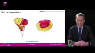 EACVI free webinar:  EuroEcho-Imaging 2016 Highlights