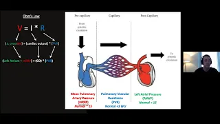 AHD Pulmonary Hypertension K Hirsch