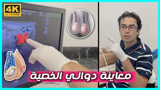 كشف سريري مباشر لمريض يعاني من دوالي الخصيتين - مع الدكتور محسن بالابان