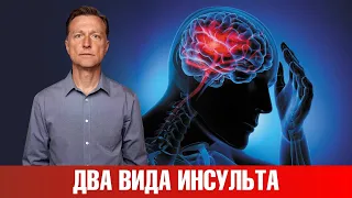 Виды инсульта. Симптомы инсульта. Геморрагический инсульт ⭕️