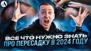 Все что нужно знать про пересадку волос в 2024 году!