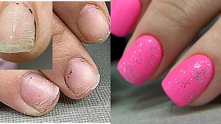 Отодрала все ногти 😬 Ногти тряпочки💅 Наращивание без форм за час💅 Зимний дизайн ногтей / Маникюр