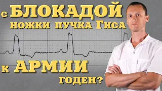 Годен к военной службе при блокаде ножки пучка Гиса?