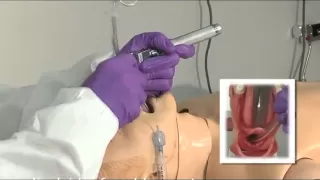 Endotracheal Intubation Procedure