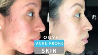 Morning & Night Time Skin Care Routine  For Oily + Acne Prone  | Using DRUGSTORE PRODUCTS