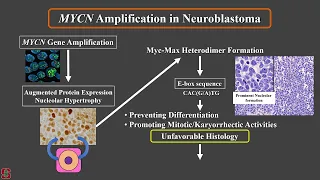 SIOP 2021 - New prognostics factors in Neuroblastoma