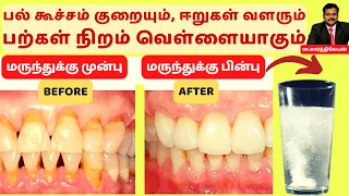 பற்கள் வெள்ளையாக | How to make tooth white? | Home remedies to Heal Receding Gums and Grow Back