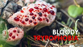Bleeding Tooth Fungus: A Bloody Nightmare