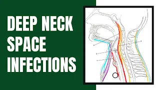 Deep Neck Space Infections