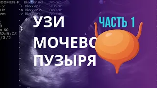 УЗИ анатомия мочевого пузыря.Толщина стенки, связки, урахус и другие особенности УЗИ мочевого пузыря