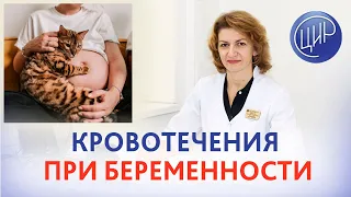 Кровотечения при беременности, 1 скрининг и хориальный полип. Дементьева С.Н.