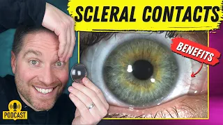 The Amazing Benefits Of Scleral Contact Lenses!