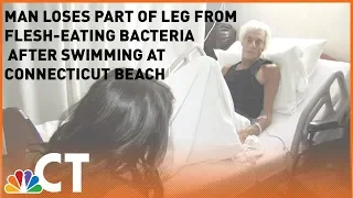 Connecticut Man Contracts Flesh-Eating Bacteria After Swimming at Hammonasset