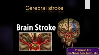 5-cerebral stroke