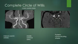 Circle of Willis