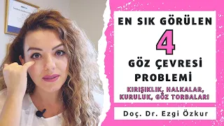 En Sık Görülen 4 Göz Çevresi Sorunu Nasıl Çözülür? Kırışıklık-Halkalar-Gözaltı Torbaları Tedavisi