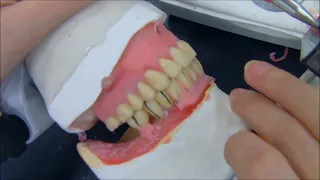 Prótese Total para iniciantes Parte 4 - Montagem de Dentes Posteriores Inferiores