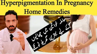Home Remedies for Hyperpigmentation Melasma Dark Spots During Pregnancy | Dr Nadeem Pharmacist