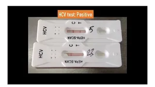 HCV test positive Test yourself at home