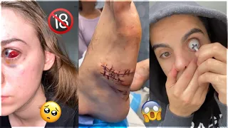 Hey Yo, Something Traumatic Happened That Changed My Life Check | Extreme TikTok Compilation #3