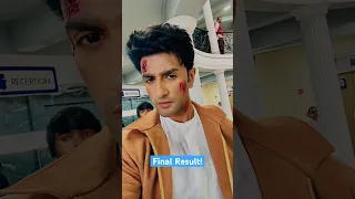 Quick easy face injury makeup tutorial #makeuptutorial #makeupshorts #makeuphacks #nishantmalkani