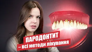 🇺🇦 Пародонтит. Методи лікування пародонтиту