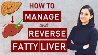 Tips to MANAGE and REVERSE FATTY LIVER DISEASE |  Non-alcoholic Fatty Liver Disease (NAFLD)