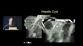 CT Hepatic Masses