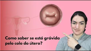 Como fica o colo do útero no inicio da gestação/ no começo da gravidez?