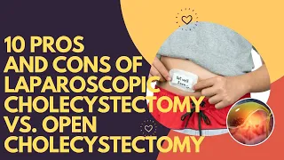 10 Pros and Cons of Laparoscopic Cholecystectomy vs. Open Cholecystectomy