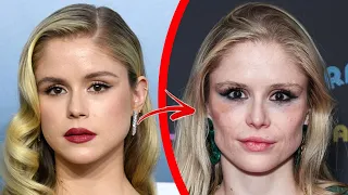 Top 10 Celebrity Plastic Surgeries That Went Way Too Far