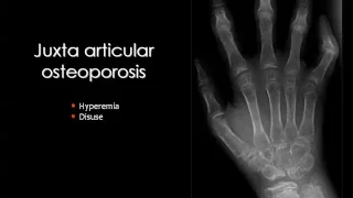 Imaging of Arthritis I Aug 2014   Dr Mamdouh Mahfouz In Arabic