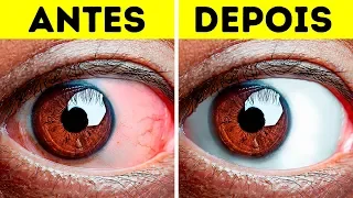 Mais de 10 Exercícios Fáceis Para Aliviar Olhos Cansados