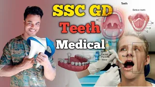SSC GD Teeth Medical | দাতৰ কাৰনে  ssc medicalত কি কি সমস্যা হয়  🤫