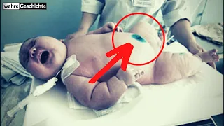 Die Ärzte konnten nicht aufhören zu schreien, als sie sahen, wie dieses Baby geboren wurde!!!