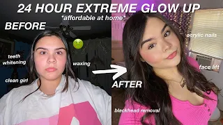 24 HOUR EXTREME GLOW UP TRANSFORMATION: nails, face lift, laser hair removal, teeth whitening & etc